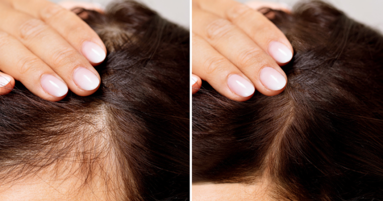 Read more about the article Are Organic Soap Nuts Good for Hair Growth?